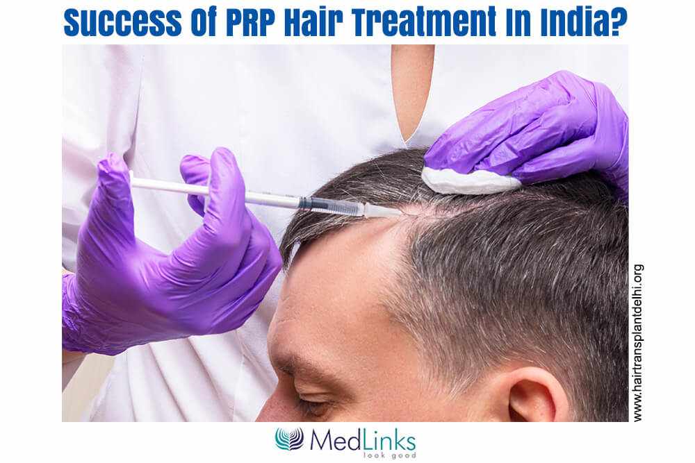What Is The Cost And Success Of Hair Regrowth Hair Treatment In India?