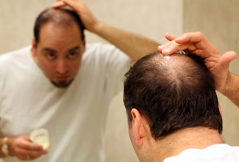 Folliculitis and Associated Problem of Hair Loss