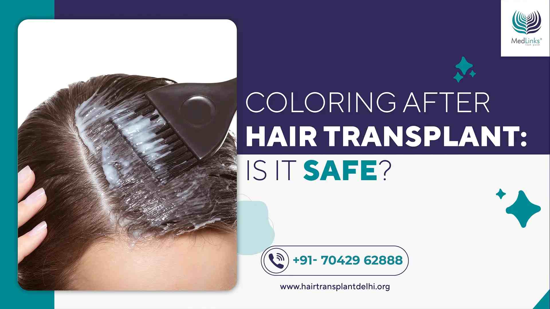 Coloring After Hair Transplant: Is It Safe?