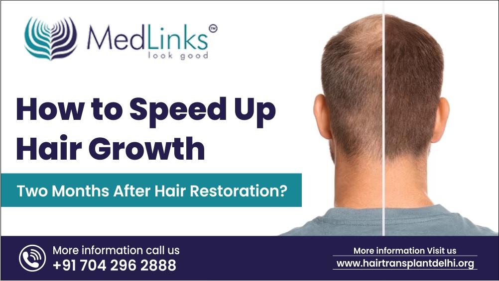 How to Speed Up Hair Growth Two Months After Hair Restoration?