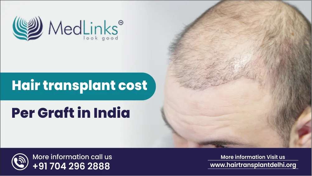 Hair Transplant Cost Per Graft in India 2024