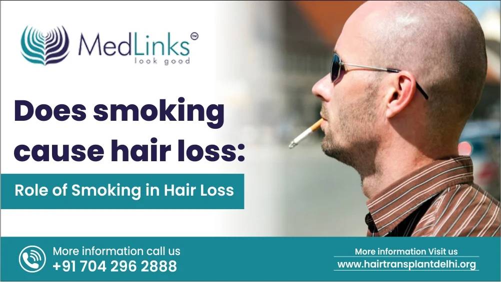 Does Smoking Cause Hair Loss: Role of Smoking in Hair Loss