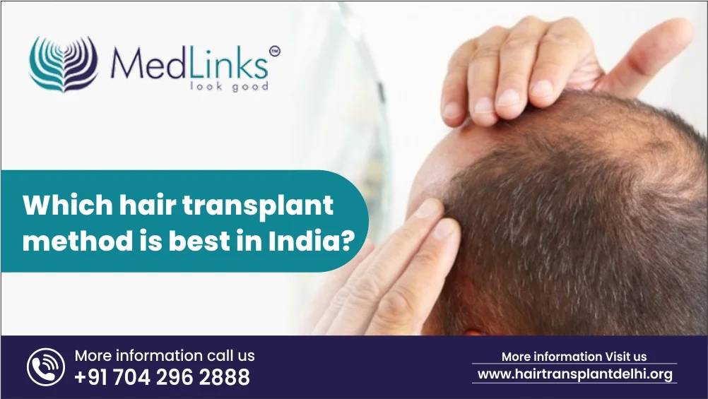 Which Hair Transplant Method is Best in India?