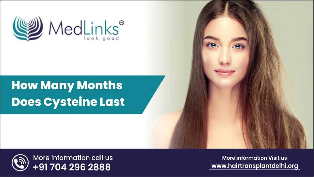 How Many Months Does Cysteine Last?