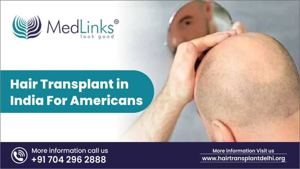 Hair Transplant in India For Americans
