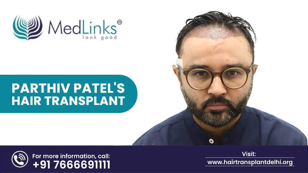 Parthiv Patel's Hair Transplant