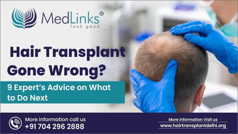 Hair Transplant Gone Wrong? 9 Expert’s Advice on What to Do Next