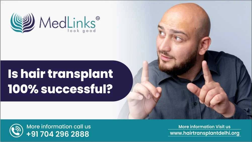 Is Hair Transplant 100% Successful?