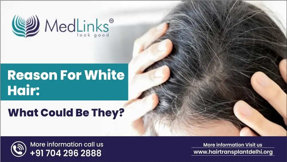 Reason for White Hair: What Could Be They?