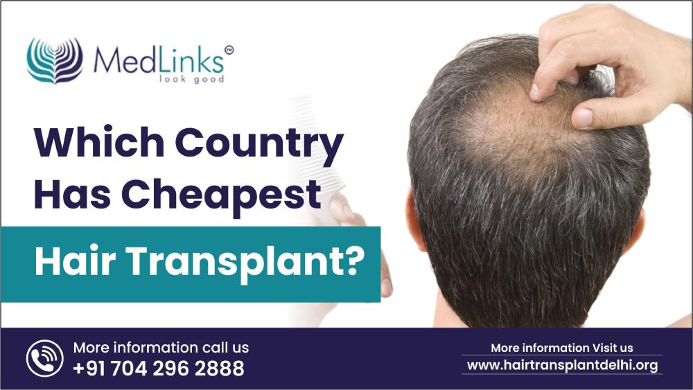 Which Country has the Cheapest Hair Transplant?