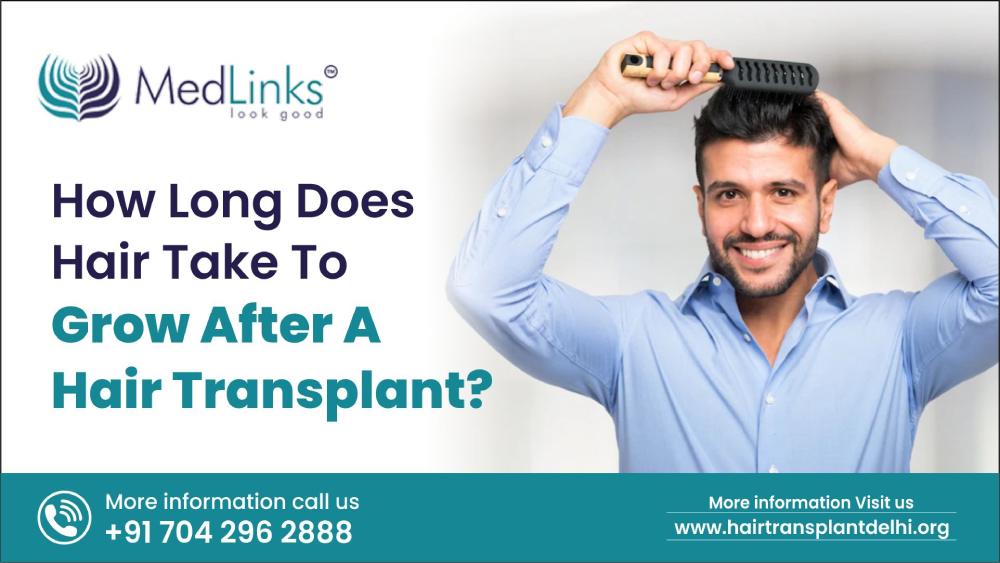 How long does hair take to grow after a hair transplant?