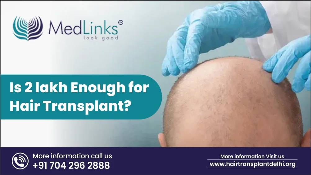 Is 2 Lakh Enough for Hair Transplant?