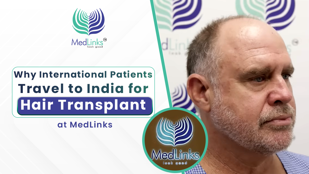 hair transplant in india