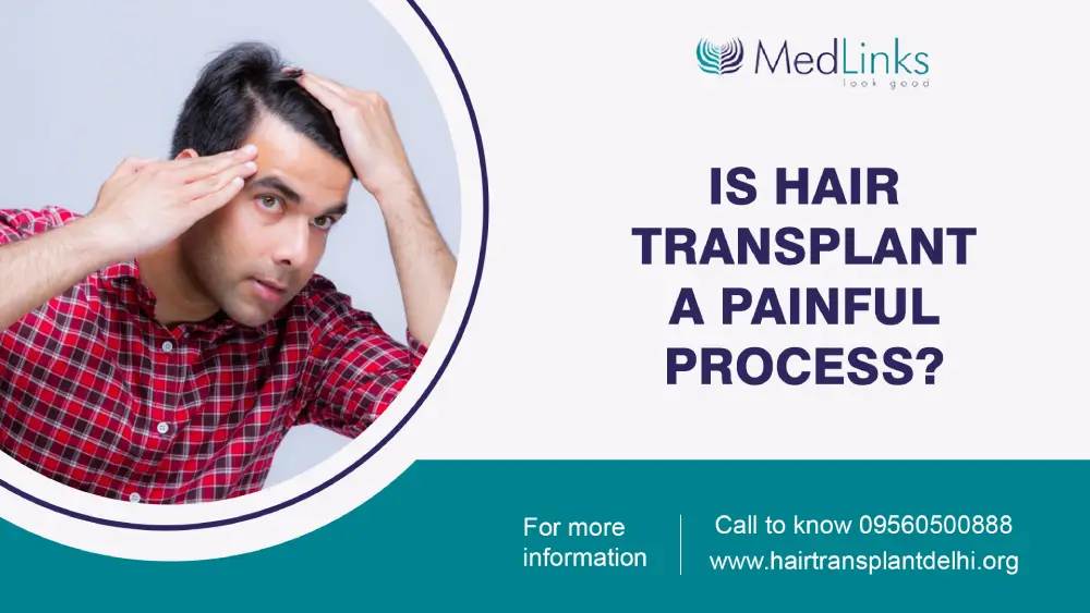 Is Hair Transplant a Painful Process?