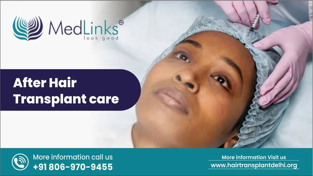  After Hair Transplant Care