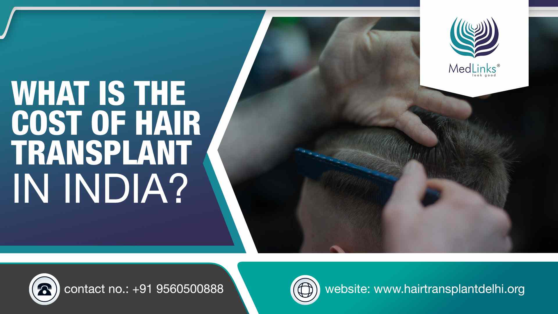 What is the Cost of Hair Transplant in India?