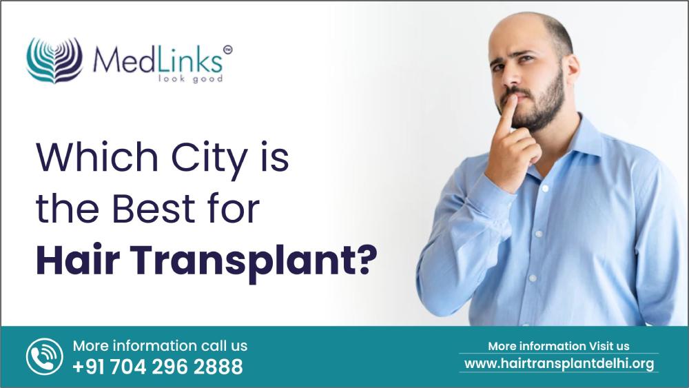 Which City is the Best for Hair Transplant in India?