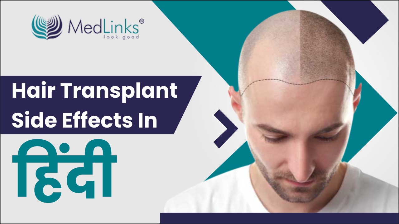 Hair transplant side effects in hindi | Medlinks