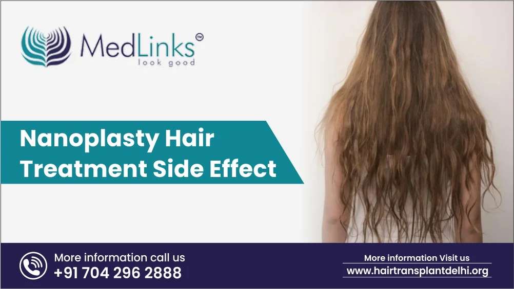 Nanoplasty Hair Treatment Side Effect