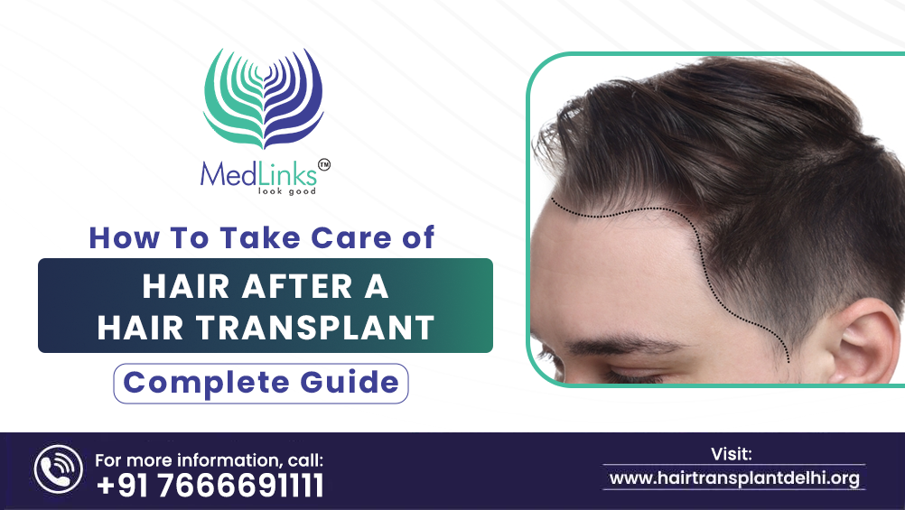 Complete Guide to Hair Transplant Aftercare | MedLinks