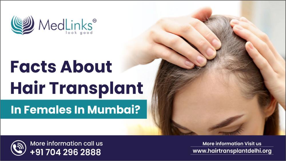Facts about  female hair transplant in Mumbai