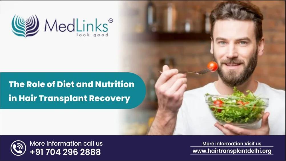 The Role of Diet and Nutrition in Hair Transplant Recovery