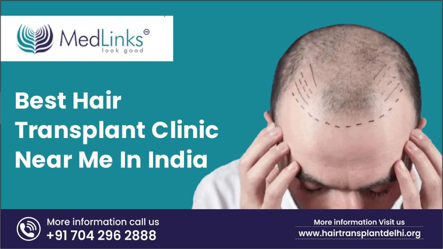 Hair Transplant Clinic Near Me in India