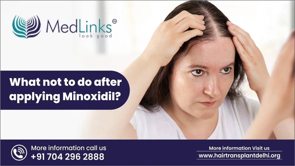 What not to do after applying minoxidil?