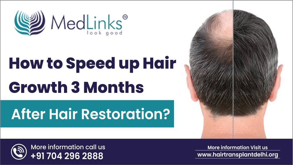 How to Speed up Hair Growth 3 Months after Hair Restoration?