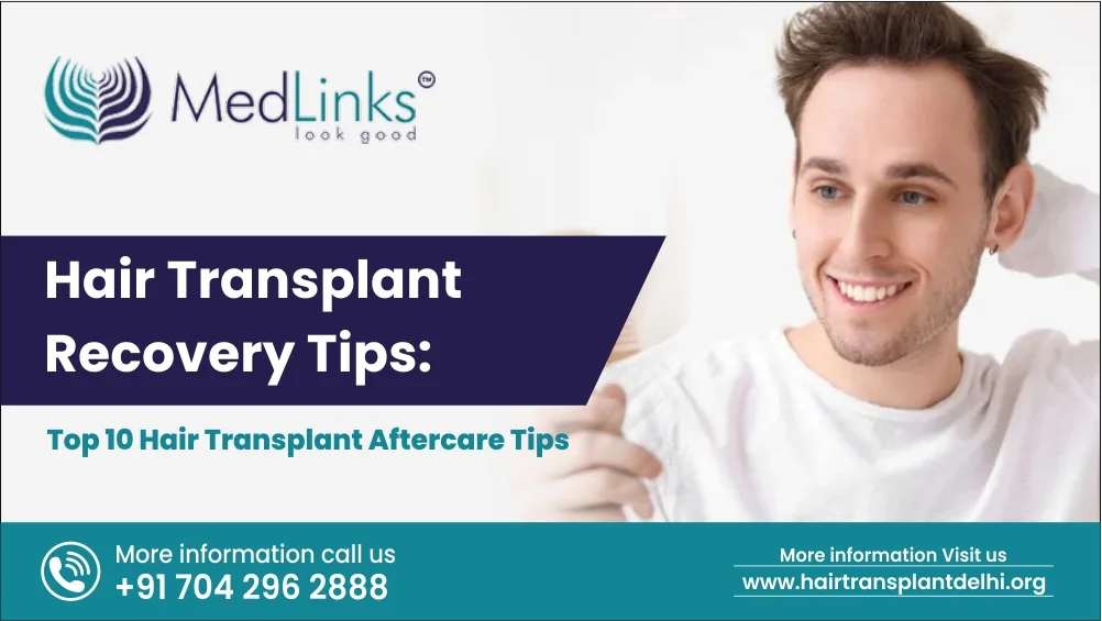Hair Transplant Recovery Tips: Top 10 Hair Transplant Aftercare Tips