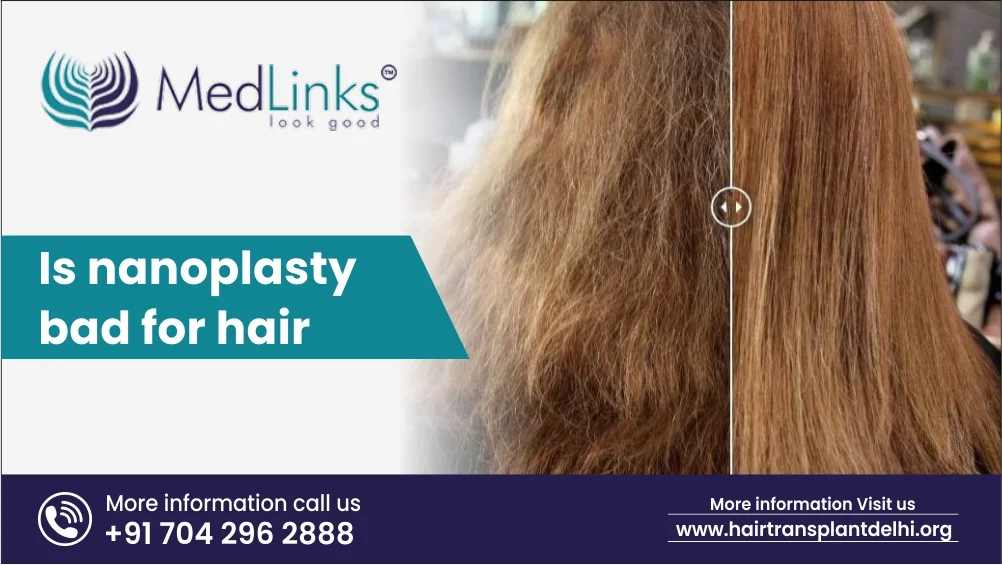 Is Nanoplasty Bad for Hair?