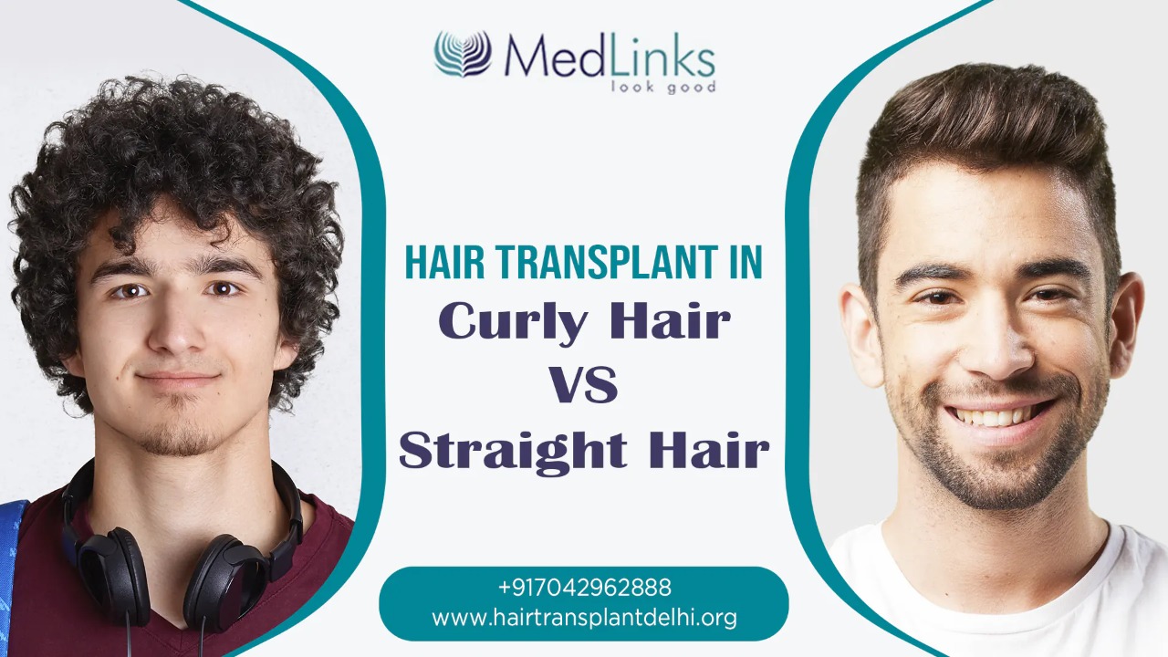 Is Hair Transplant Different for Curly and Straight Hair? | MedLinks