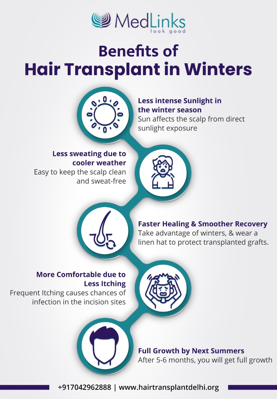 Get a Hair Transplant During the Winter Season