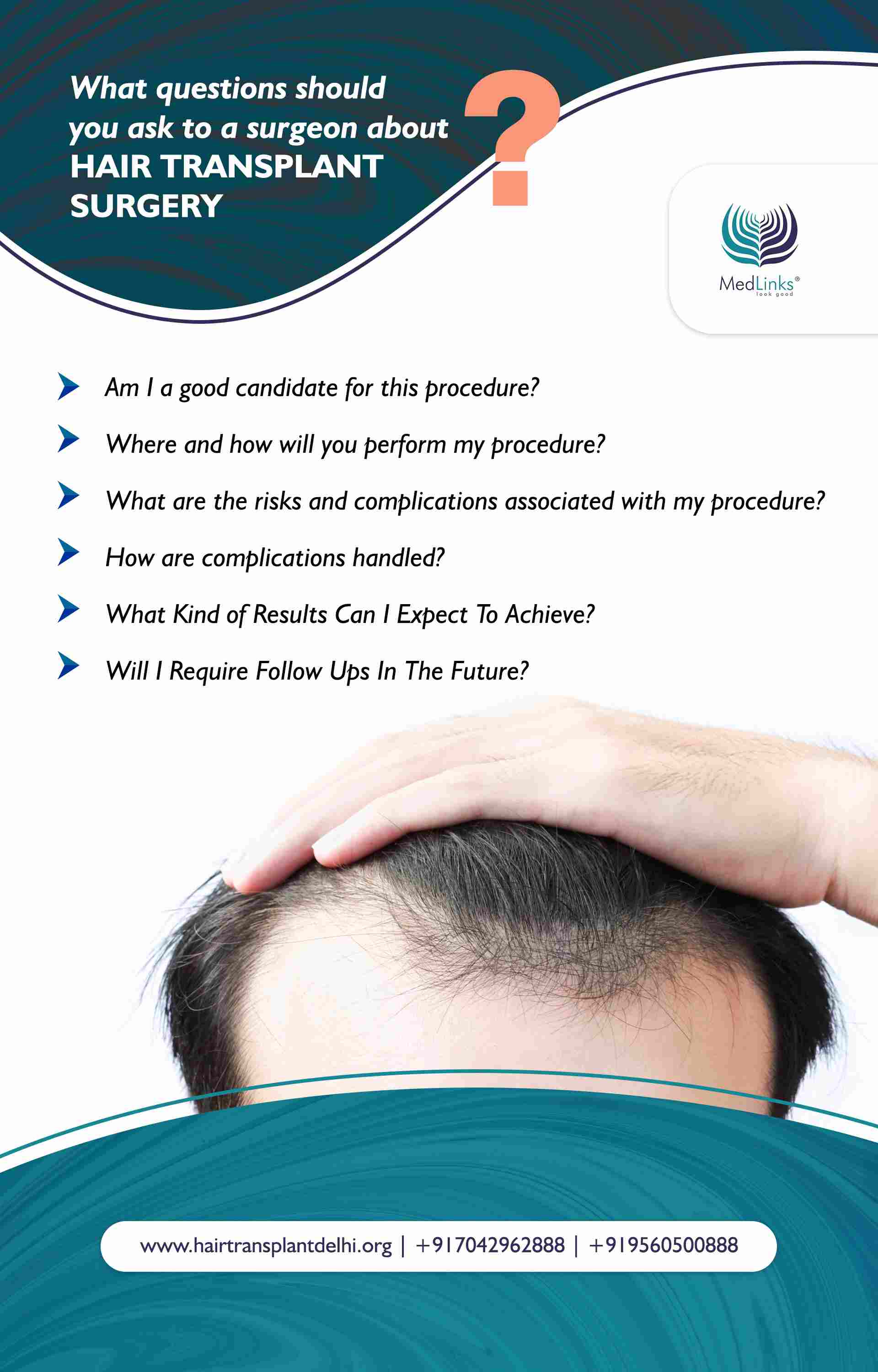 best hair transplant clinic in India